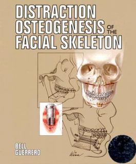 Distraction Osteogenesis of the Facial Skeleton by Cesar A. Guerrero 