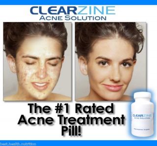 Best Acne Treatment Pill RID Pimples Clear Skin Vitamin