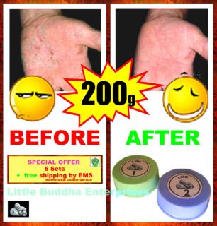 get rid of eczema 5 sets value pack 100 %
