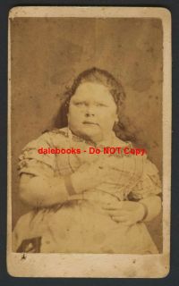 Circus Freak Show Photo CDV Barnum Fat Girl 1870 A Hill