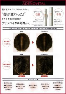 Adenovital Scalp Essence 180ml Hair Growth Solution by Shiseido Pro 