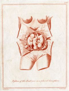 Antique Print Medical Baby Foetus UTERUS Culpeper 1790