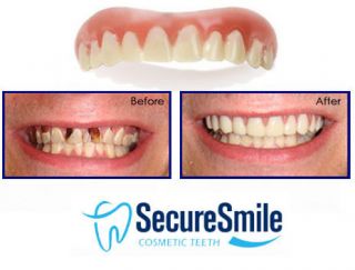 Secure Smile False Teeth Dr Baileys Cosmetic Fake Instant Dentures as
