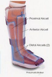 Aircast XP Pneumatic Walking Boot